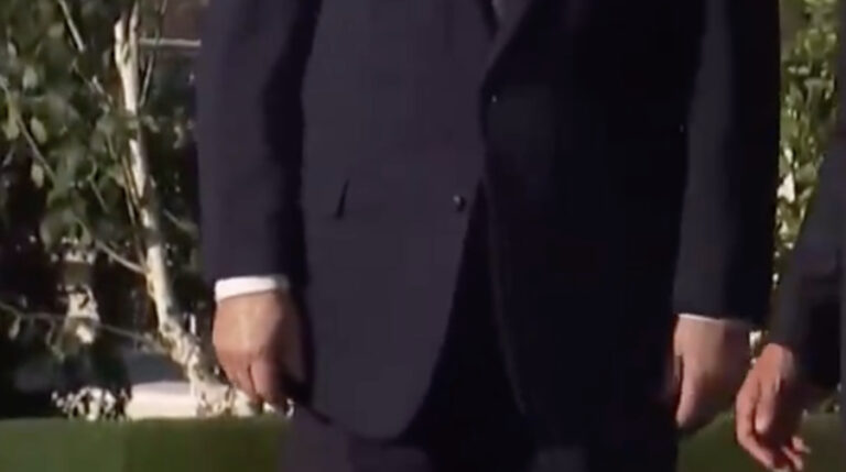 Trump’s Hand Looks Weirdly Swollen and Discolored at G7 Summit in France